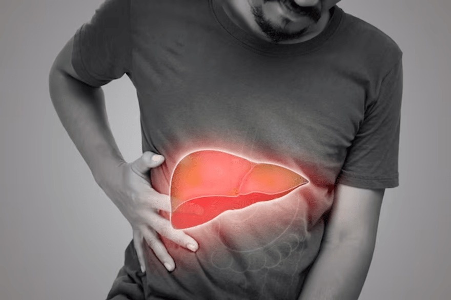 Acute liver failure